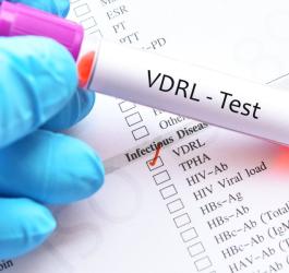 Diagnosta trzyma w dłoni fiolkę z krwią przeznaczoną do testy VDRL - badania w kierunku kiły.