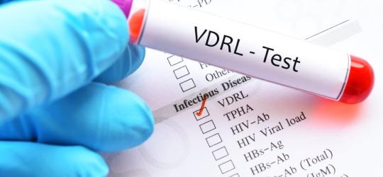 Diagnosta trzyma w dłoni fiolkę z krwią przeznaczoną do testy VDRL - badania w kierunku kiły.