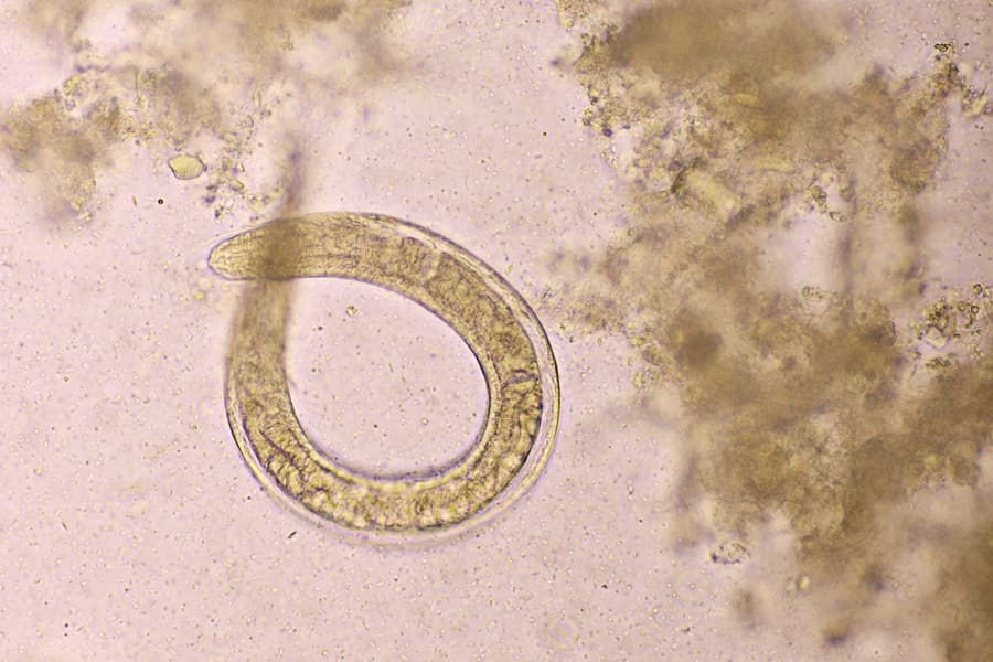 Larwa węgorka jelitowego pod mikroskopem.