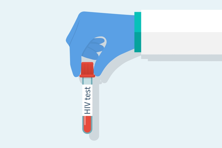 Wirus HIV - objawy, test, leczenie