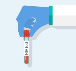 Wirus HIV - objawy, test, leczenie