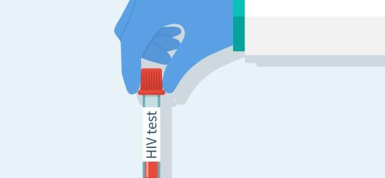 Wirus HIV - objawy, test, leczenie