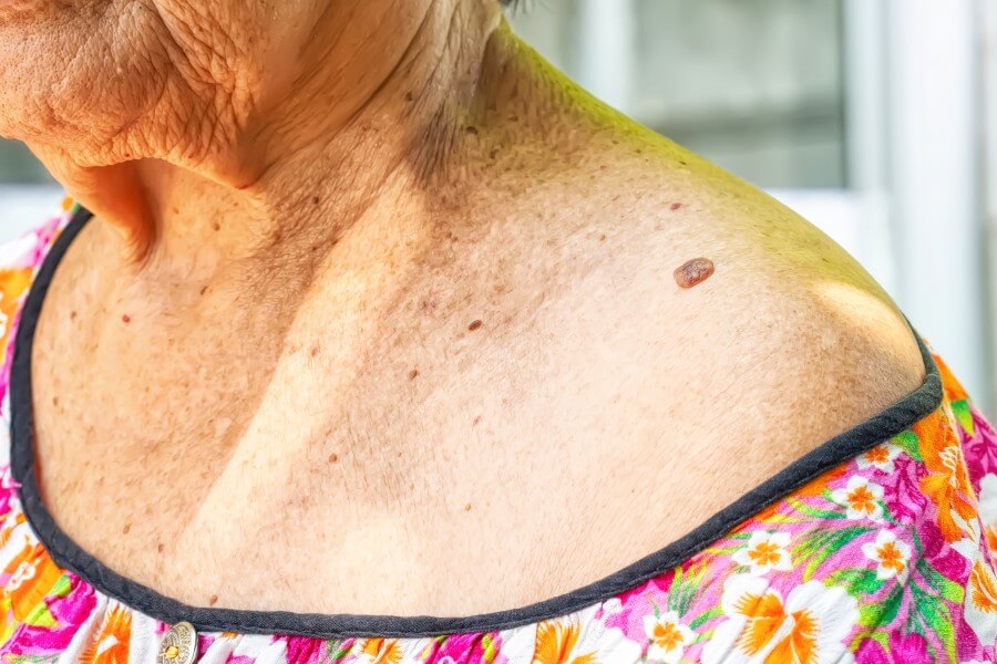 Włókniak miękki i twardy