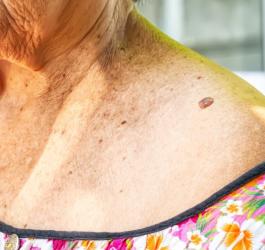 Włókniak miękki i twardy