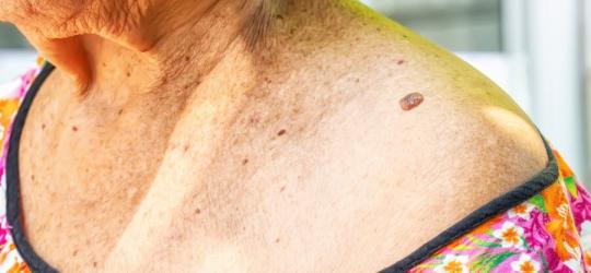 Włókniak miękki i twardy