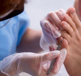 Wrastający paznokieć