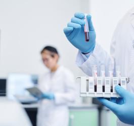 Diagności w laboratorium. Jeden z nich trzyma w ręce próbówki z krwią przeznaczoną do badań.