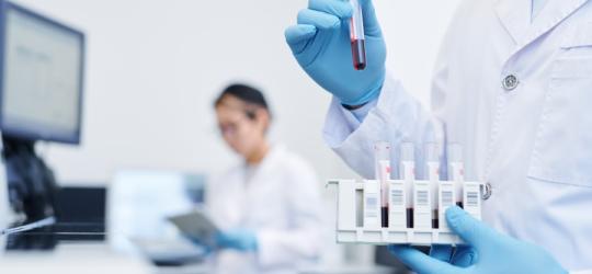 Diagności w laboratorium. Jeden z nich trzyma w ręce próbówki z krwią przeznaczoną do badań.