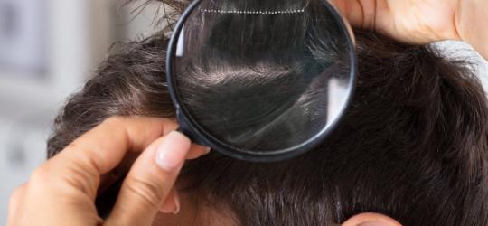 Wszawica - przyczyny i leczenie