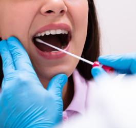 Kobieta ma pobierany wymaz z gardla.