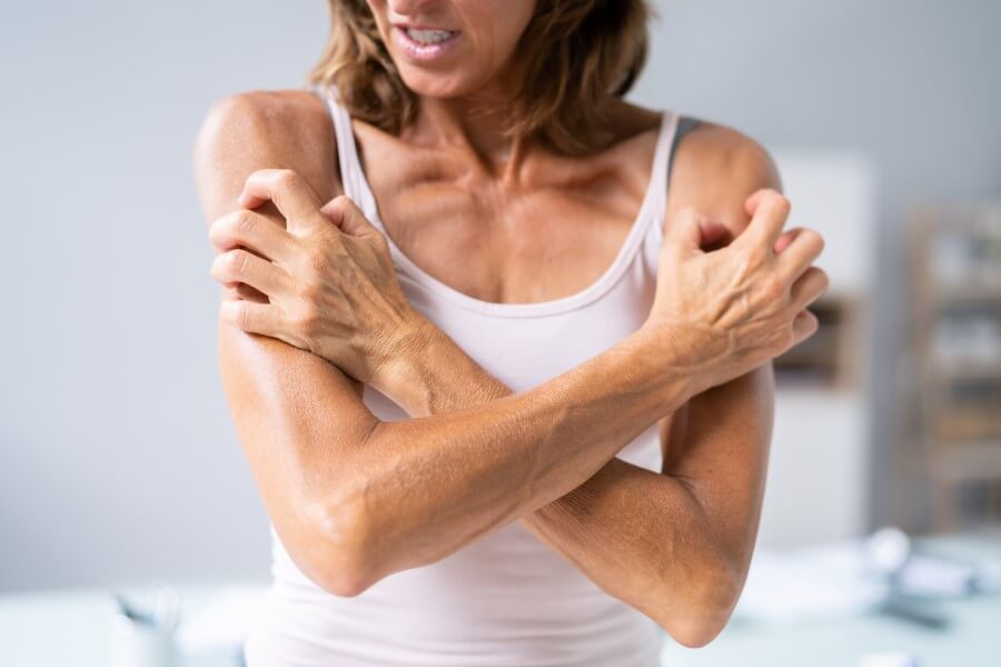 Kobieta ma na skórze wysypkę alergiczną, mocno drapie się po ramionach.