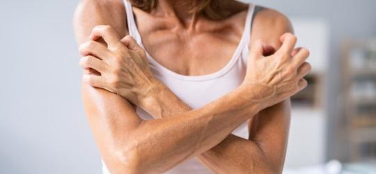 Kobieta ma na skórze wysypkę alergiczną, mocno drapie się po ramionach.