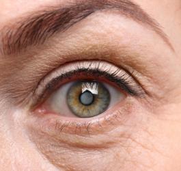Zaćma - groźna choroba oczu. Jak wygląda leczenie?