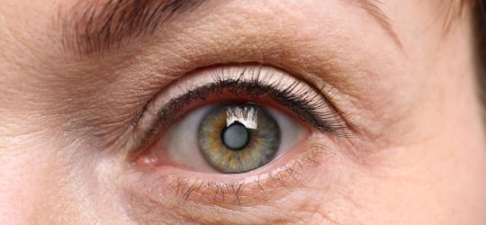 Zaćma - groźna choroba oczu. Jak wygląda leczenie?