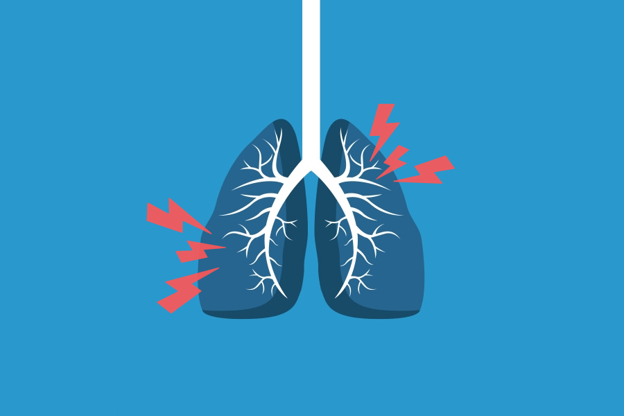 Zapalenie oskrzeli - jak rozpoznać i jak leczyć?