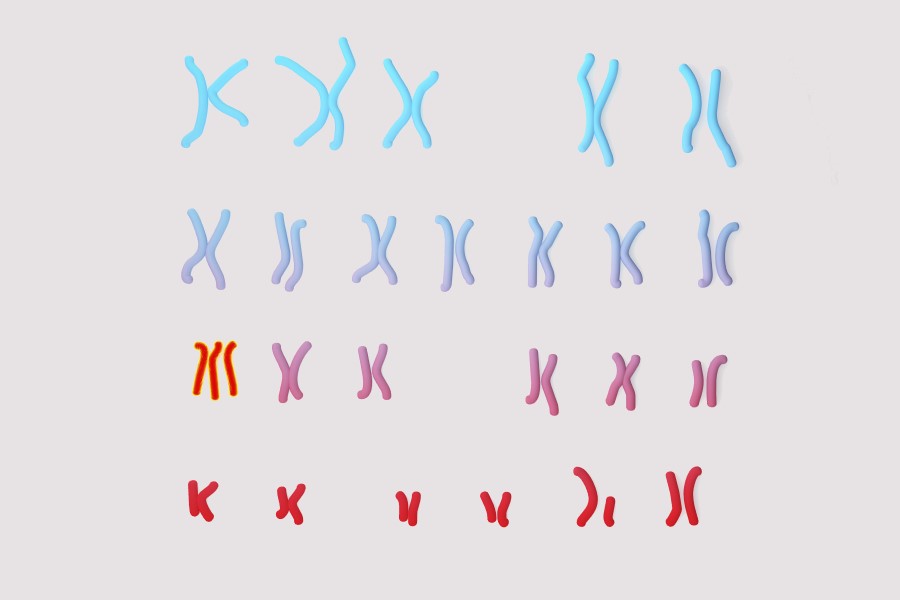 Grafika 3D wskazująca na trisomię chromosomu 13.