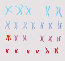 Grafika 3D wskazująca na trisomię chromosomu 13.