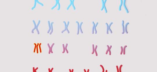 Grafika 3D wskazująca na trisomię chromosomu 13.