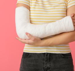 Kobieta z usztywnioną ręką po złamaniu kości.