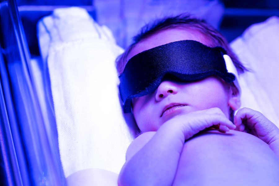 Żółtaczka - objawy i leczenie