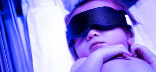 Żółtaczka - objawy i leczenie